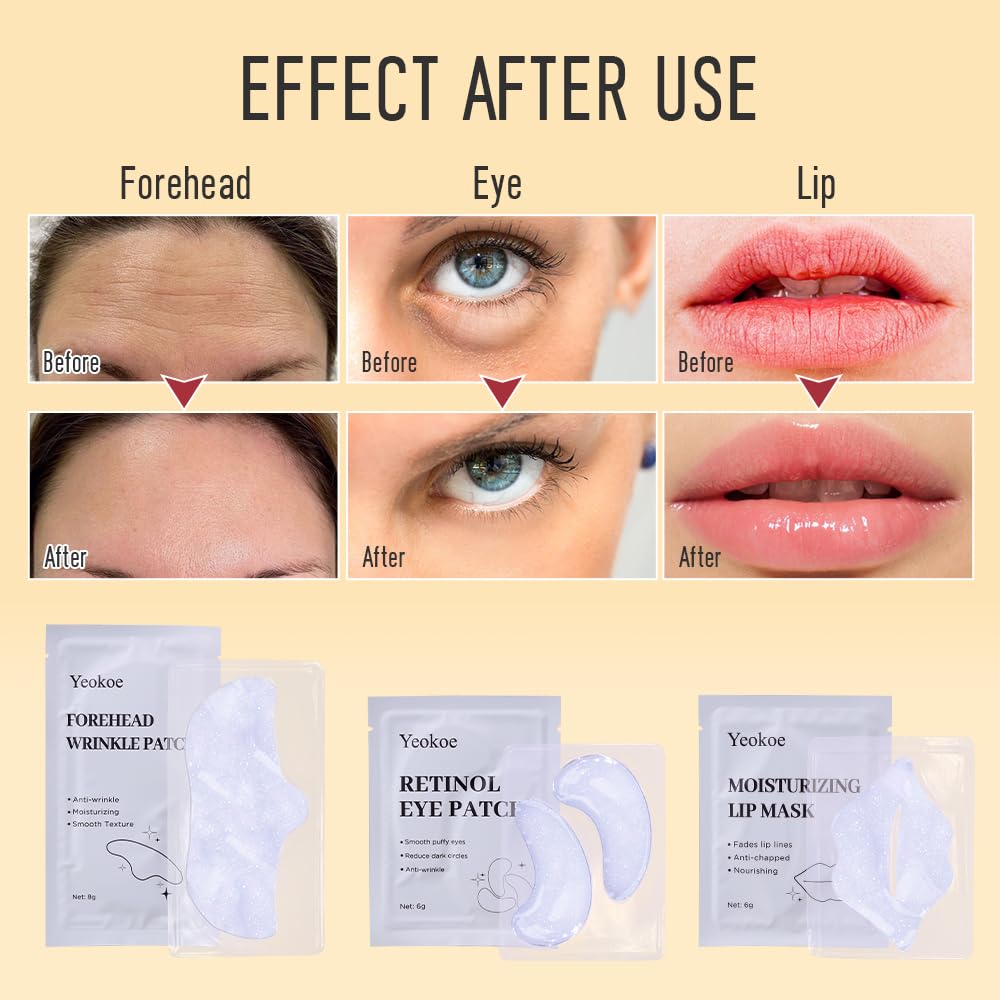 Yeokoe Under Eye Patches for Dark Circles,Eye Mask for Puffy Eyes With Collagen,Retinol,Vitmin C,Hyaluronic Acid and Niacinamide Face Masks Skincare Spa Gifts for Woman 20Pairs