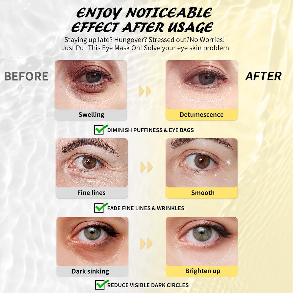 Maskiss Under Eye Patches (50 Pairs), Hyaluronic Acid Eye Masks for Dark Circles Puffy Eyes Undereye Bags, Collagen Eye Patches for Wrinkles and Hydrate, Skin Care Gift for Her