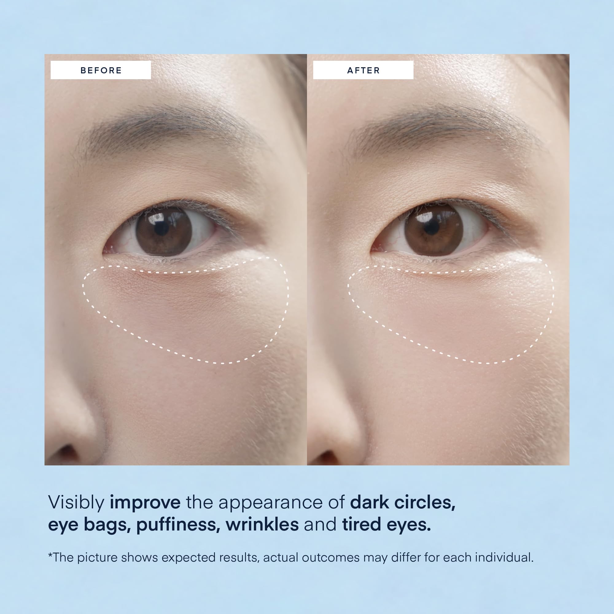 TEREZ & HONOR Peptide Collagen Under Eye Patches - 60 Korean Firming, Glowing & Hydrating Hydrogel Mask for Puffy Eyes, Dark Circles, Wrinkles, Fine Lines, Undereye Bags - Anti-Aging Eye Gel Pads