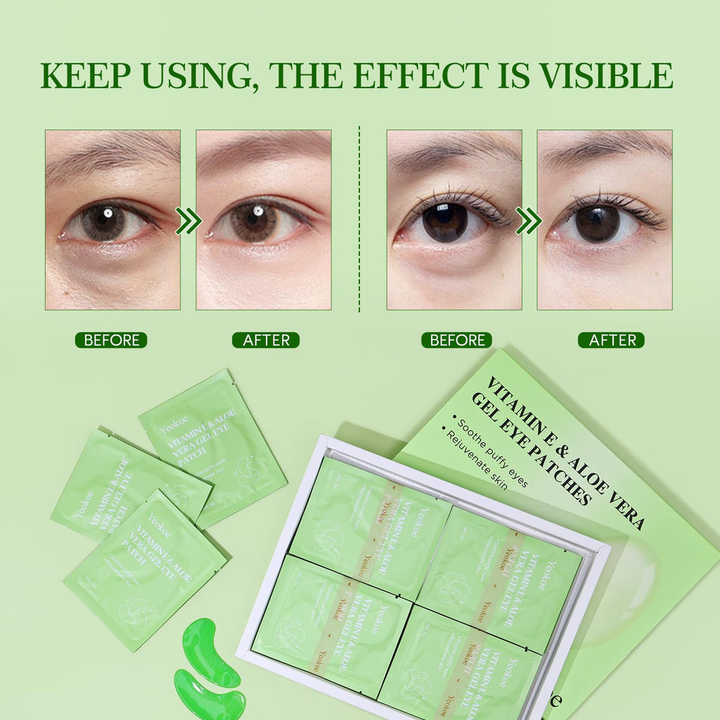 Yeokoe Under Eye Patches for Dark Circles,Eye Mask for Puffy Eyes With Collagen,Retinol,Vitmin C,Hyaluronic Acid and Niacinamide Face Masks Skincare Spa Gifts for Woman 20Pairs