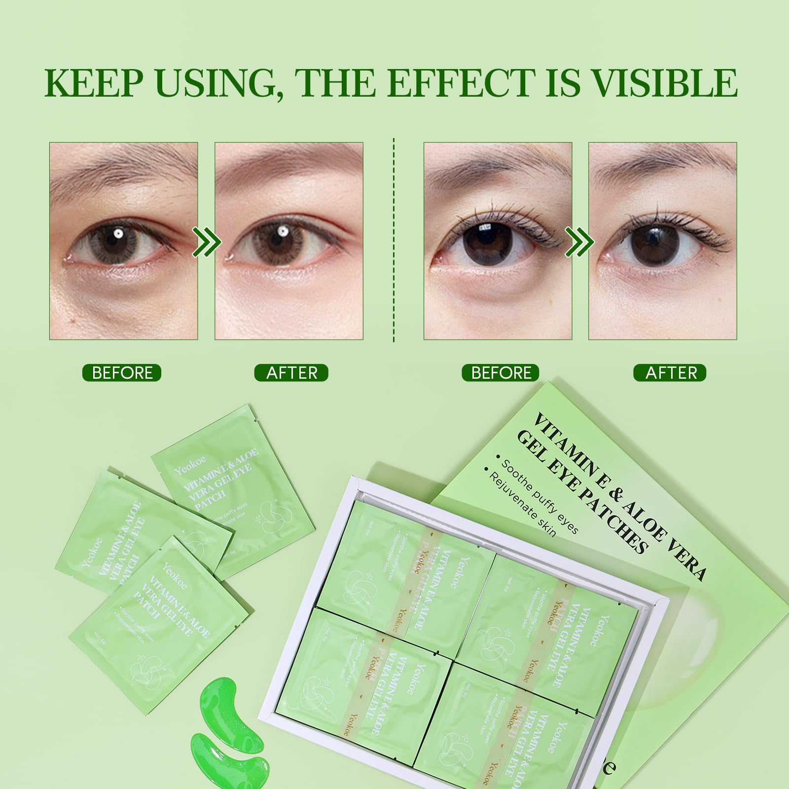 Yeokoe Under Eye Patches for Dark Circles,Eye Mask for Puffy Eyes With Collagen,Retinol,Vitmin C,Hyaluronic Acid and Niacinamide Face Masks Skincare Spa Gifts for Woman 20Pairs
