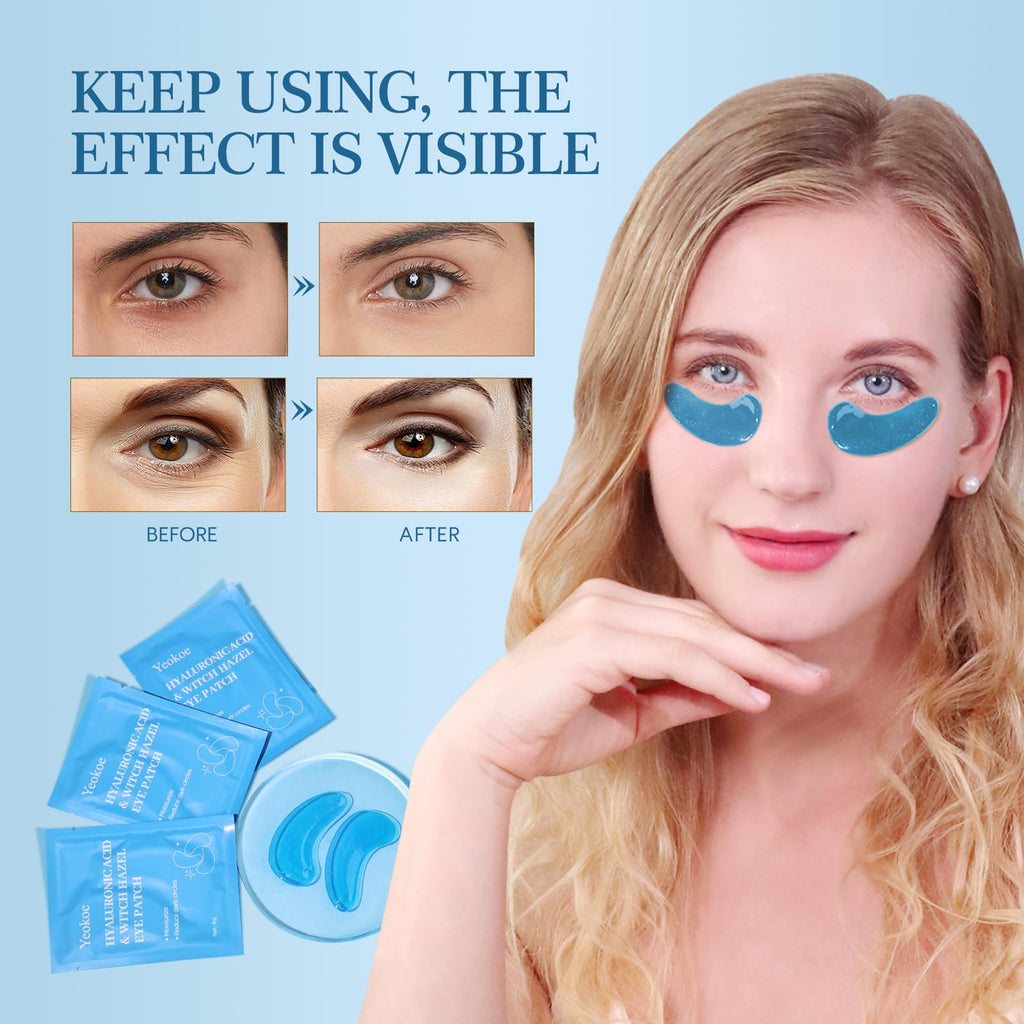 Yeokoe Under Eye Patches for Dark Circles,Eye Mask for Puffy Eyes With Collagen,Retinol,Vitmin C,Hyaluronic Acid and Niacinamide Face Masks Skincare Spa Gifts for Woman 20Pairs