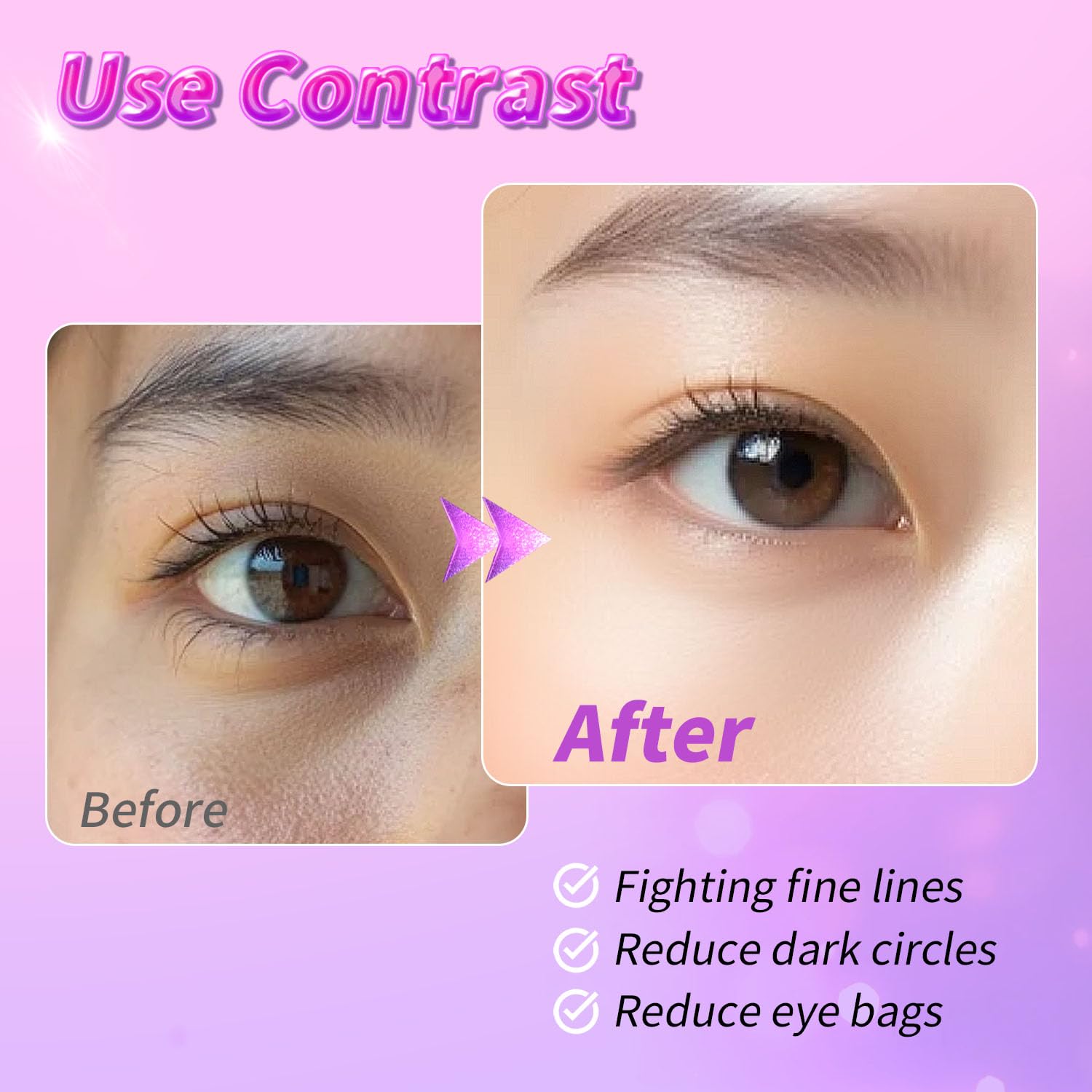 Onespring Eye Masks, Under Eye Patches for Puffiness, Retinol Collagen Eye Gel Pads, Reduce Wrinkles, Eye Bags & Dark circles - Face Mask Skincare, Anti Aging & Moisturizer, 24 Pairs