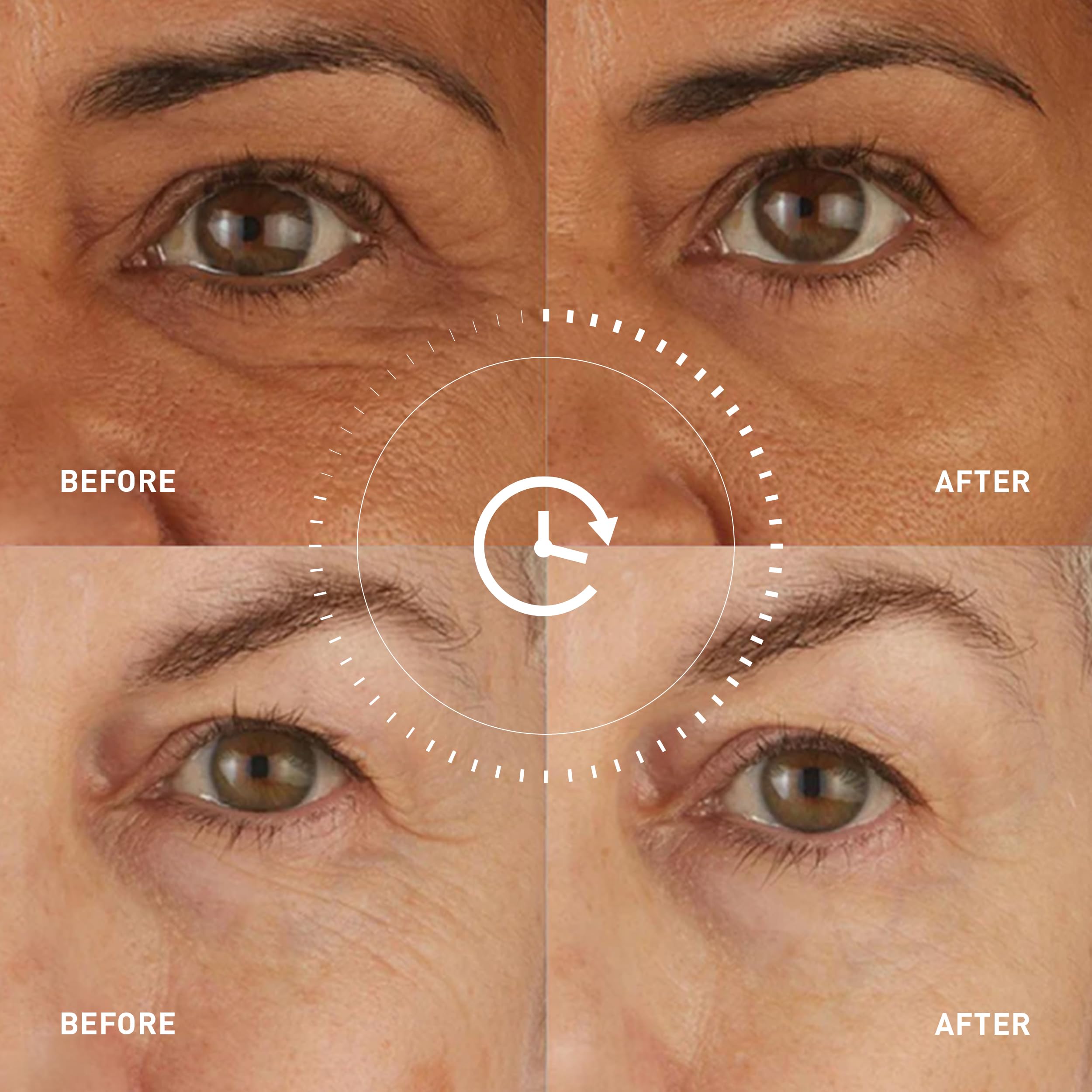 skyn ICELAND Hydro Cool Firming Under Eye Patches. Eye Gel Mask to Firm And Reduce Wrinkles, Fine Lines, Dark Circles, Puffy Eyes & Bags, 4 Pairs
