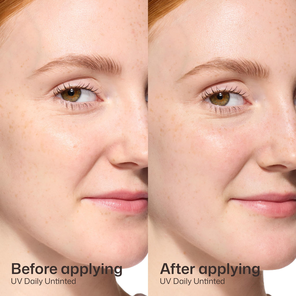 EltaMD UV Daily SPF Face Sunscreen Moisturizer with Zinc Oxide, Daily Face Moisturizer with SPF, Sunscreen for Dry Skin